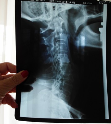 X-Ray.jpg